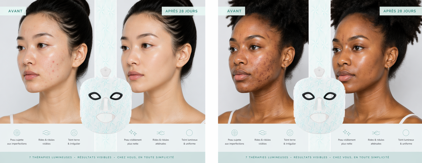 Masque LED Facial Luxora™ 7 Lumière